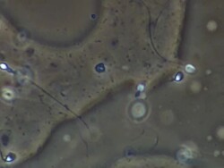 Human sperm swimming, close up, Phase contrast Stock Footage