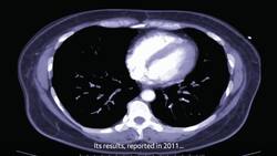 How to spot the deadliest form of cancer Instructional Video