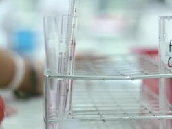 Medical students are tested chemically,Steadicam shot Stock Footage