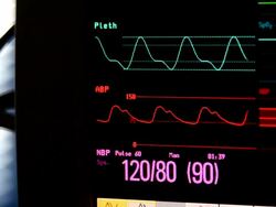 Vital signs monitor Stock Footage