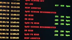 vital signs Stock Footage