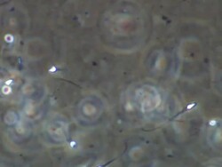 Human sperm, lots swimming around Stock Footage