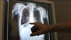 Smoking is one of Hungary''s biggest killers News Clip