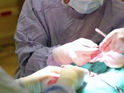 Surgeon examines tumor Stock Footage