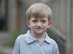 Slow motion of young boy with cleft lip standing and smiling. Stock Footage
