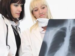 Two female doctor looking at x-ray image Stock Footage