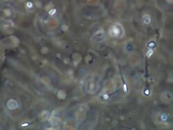 Human sperm swimming positively through others Stock Footage