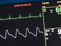 Vital signs MOnitor Stock Footage