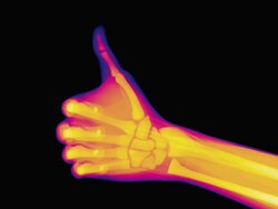 Thumbs-up, coloured X-ray Stock Footage