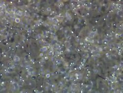 Human sperm, masses swimming around, medium wide locked off Stock Footage