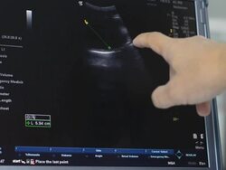 Ultrasound Stock Footage