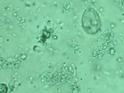 Microorganisms - paramecium Stock Footage