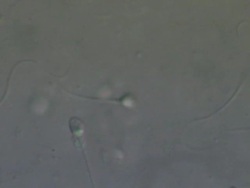 Human sperm, close up Stock Footage