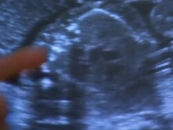 Midwife Showing Couple Ultrasound Scan News Clip