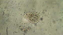 Microorganism, Sun animalcule, Actinospherium Stock Footage