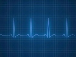 EKG Pulse Monitor Stock Footage