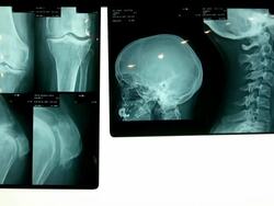 X-Ray Image (HD) Stock Footage