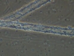 Differential Interference Contrast cinemicrography showing fungal hyphae of Sewage Fungus surrounded by abundant bacteria. Stock Footage