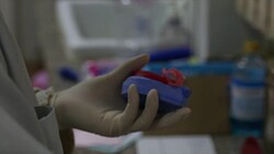 dental implant. Stock Footage