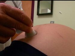 Although doctors are at odds about when a fetus can feel pain during development, it's an issue that could change the way abortions are regulated in the U.S. A new controversial law in Nebraska bans abortions after 20 weeks of pregnancy. News Clip