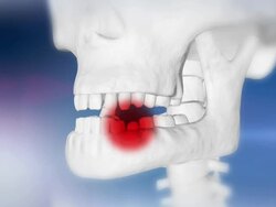 HD: Human Skull With An Aching Tooth Stock Footage