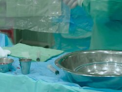 Vascular surgery. Stock Footage