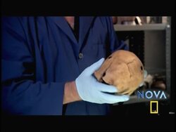 Hole in skull believed to be earliest gunshot wound in Americas Instructional Video