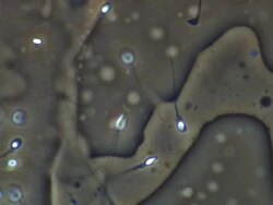 Human sperm swimming, close up, Phase contrast Stock Footage