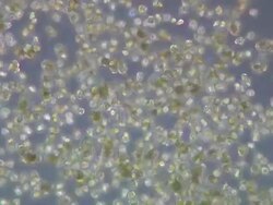 Dinoflagellates (Peridinium sp.) moving around Stock Footage