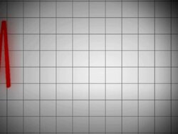 EKG Heart Monitor with shape V2 Stock Footage