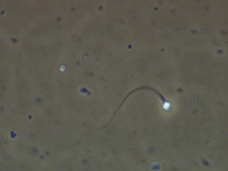 Human sperm swimming, Phase contrast Stock Footage