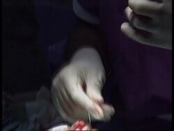 PHILIPPINES: MANILA: OPERATION RAINBOW TO HELP FILIPINO CHILDREN News Clip