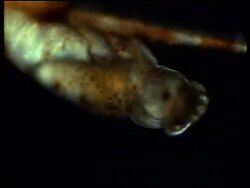 CU microscopic view of Head louse hatching, edited sequence, United Kingdom; SEQUENCE OF CLIPS, SPECIAL TERMS APPLY Stock Footage