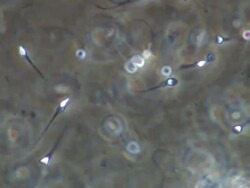 Human sperm, lots swimming around, locked off Stock Footage