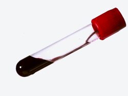 CU Shot of Blood in Test Tube against White Background / Calvados, Normandy, France Stock Footage