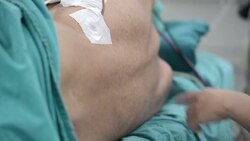 Doctor exam spine Stock Footage