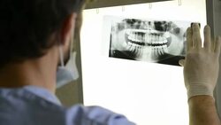 Dentist at work Stock Footage