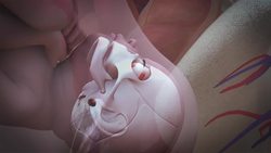 Scientists generate retinal tissue from stem cells Instructional Video