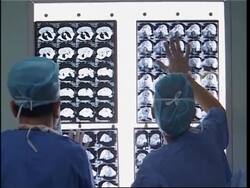 Surgery for man with massive facial tumour News Clip