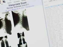 CU TU TD PAN Files and x-rays of neck and spine on computer screen with female hand navigating through screens / Toronto, Ontario, Canada Stock Footage