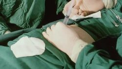 MONTAGE Doctors injecting patient with hypodermic needle during surgical procedure / United Kingdom Stock Footage