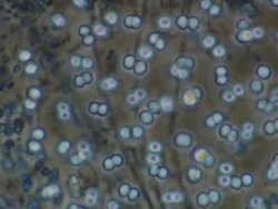 Blue green algae Stock Footage