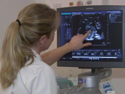 Midwife Showing An Ultrasound Scan News Clip
