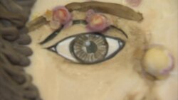 Medical matters: A fright fest of gory cakes News Clip