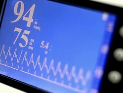 Pulse Trace Stock Footage