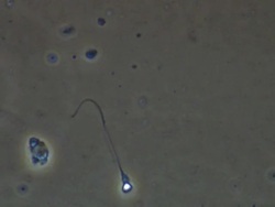Human sperm, single sperm swimming Stock Footage