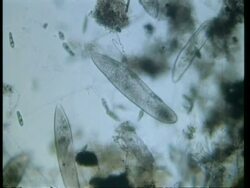 CU microscopic view of Paramecium, Stentor and Euglena Stock Footage
