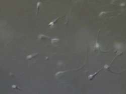 Human sperm swimming, race, Interference contrast Stock Footage