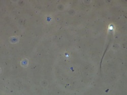 Single Human sperm swimming, Phase contrast Stock Footage