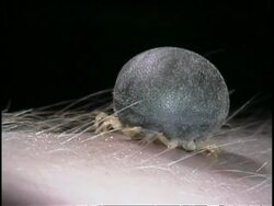 Parasite/Vector - African Tick (Ornithodorus moubata) CU tick on human skin Stock Footage
